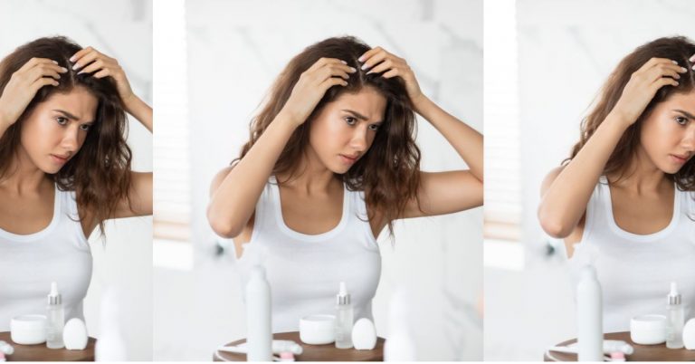 How To Get Rid Of Dandruff Naturally